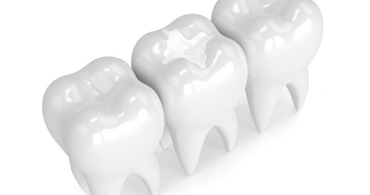 Dental Clinic Bossley Park