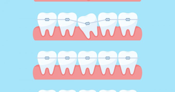 Orthodontist Strathfield Orthodontist Homebush Orthodontist Homebush West Orthodontist Burwood
