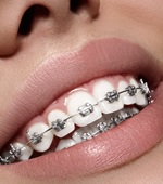 Orthodontics